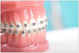 tratamientos dentales 18