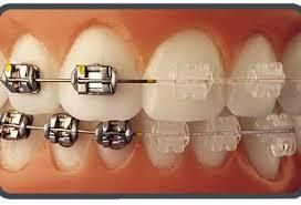 tratamientos dentales 19