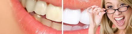 tratamientos dentales 1