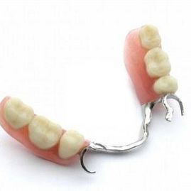 tratamientos dentales 7
