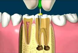 tratamientos dentales 14