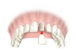 tratamientos dentales 8