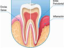 tratamientos dentales 10