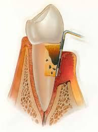 tratamientos dentales 11