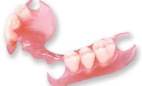 tratamientos dentales 5