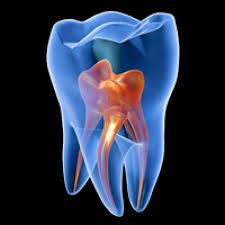 tratamientos dentales 15