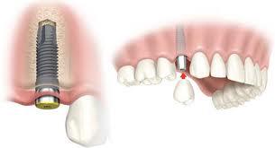 tratamientos dentales 24