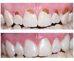 tratamientos dentales 2