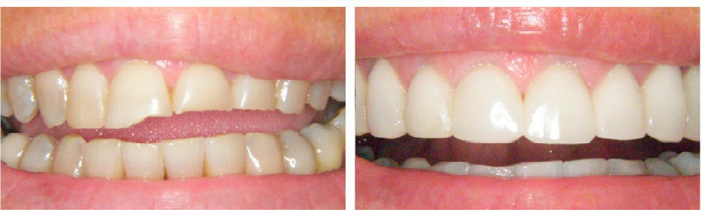tratamientos dentales 6